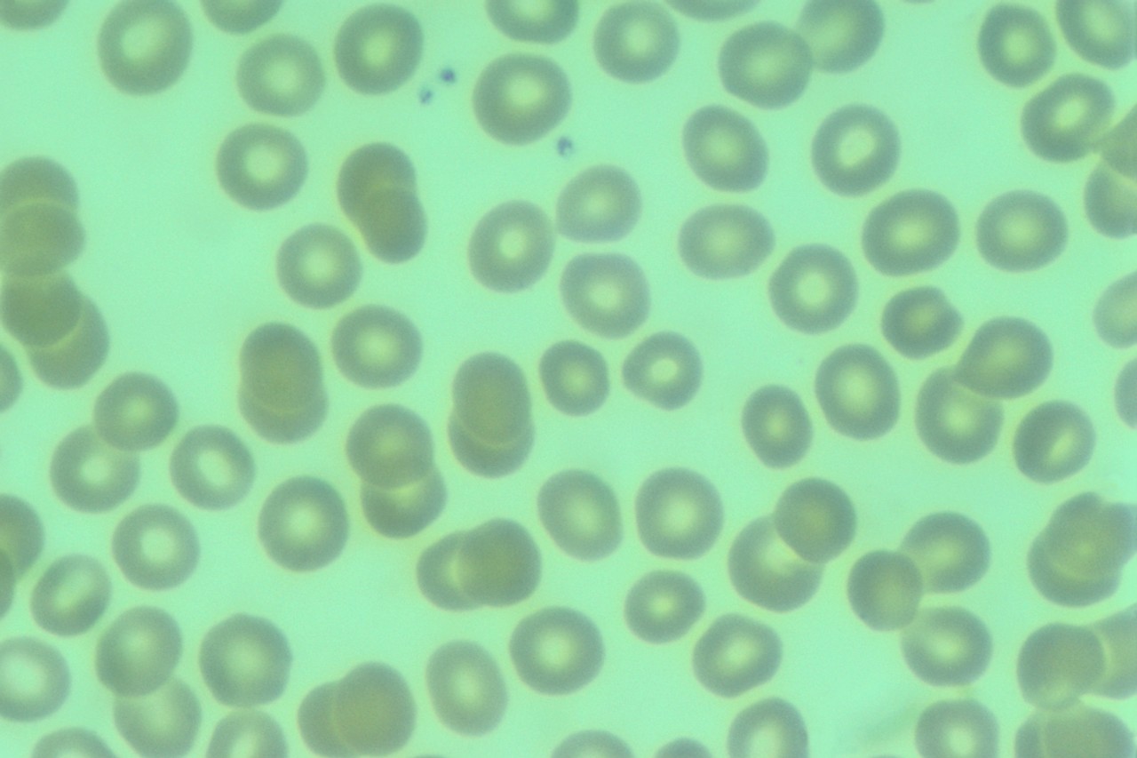Blood